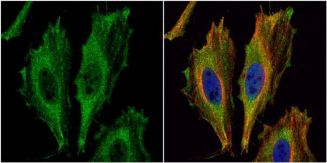 Aspartoacylase Antibody in Immunocytochemistry (ICC/IF)