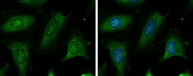 CBS Antibody in Immunocytochemistry (ICC/IF)