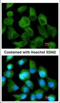 CLN2 Antibody in Immunocytochemistry (ICC/IF)