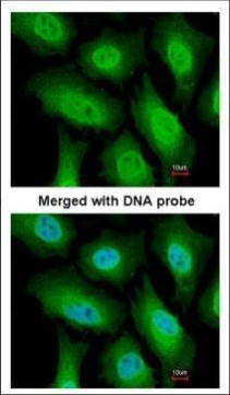 FANCA Antibody in Immunocytochemistry (ICC/IF)