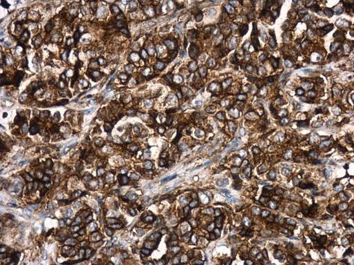 HLA-DR Antibody in Immunohistochemistry (Paraffin) (IHC (P))