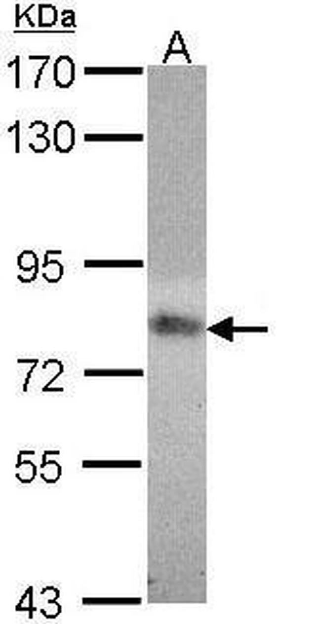 MTHFR Antibody in Western Blot (WB)