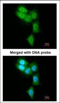PSMB8 Antibody in Immunocytochemistry (ICC/IF)