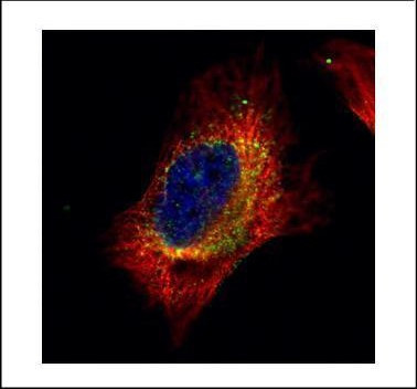 Cofilin 2 Antibody in Immunocytochemistry (ICC/IF)
