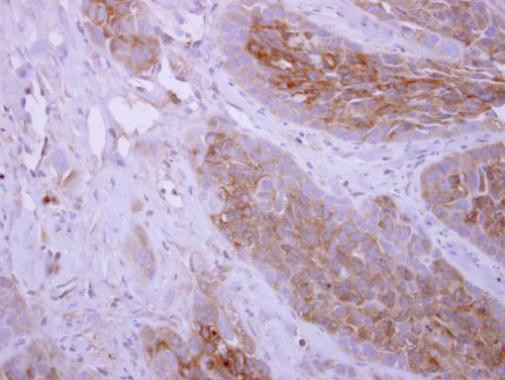 DPYD Antibody in Immunohistochemistry (Paraffin) (IHC (P))