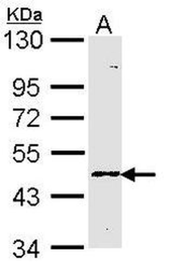 Blood Group Lewis A Antibody in Western Blot (WB)