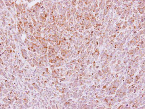 Laminin gamma-2 Antibody in Immunohistochemistry (Paraffin) (IHC (P))