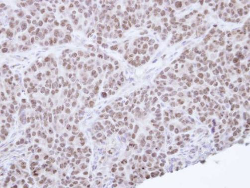 NR0B2 Antibody in Immunohistochemistry (Paraffin) (IHC (P))