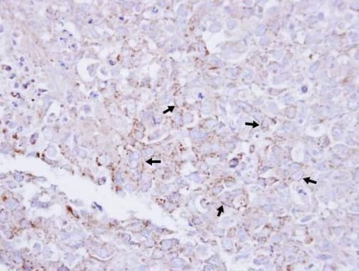MTMR2 Antibody in Immunohistochemistry (Paraffin) (IHC (P))