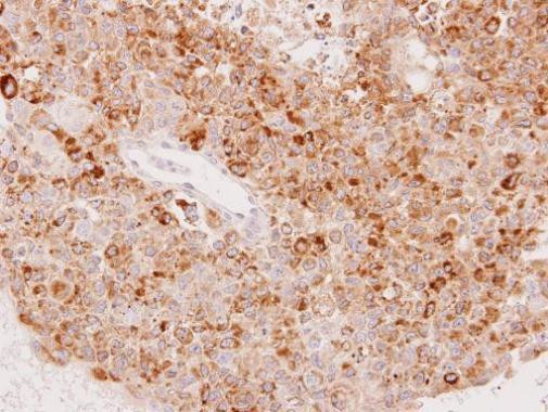 UGT1A6 Antibody in Immunohistochemistry (Paraffin) (IHC (P))