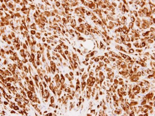 PMM2 Antibody in Immunohistochemistry (Paraffin) (IHC (P))