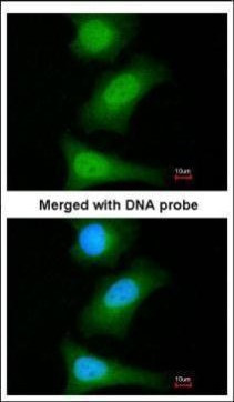 Livin Antibody in Immunocytochemistry (ICC/IF)