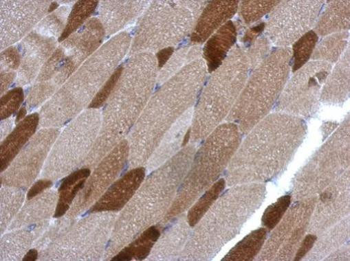 RGS4 Antibody in Immunohistochemistry (Paraffin) (IHC (P))