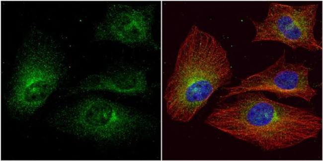 ALPPL2 Antibody in Immunocytochemistry (ICC/IF)