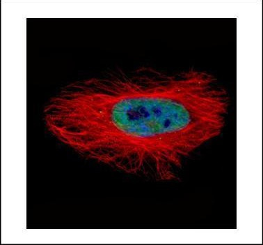 Arylsulfatase A Antibody in Immunocytochemistry (ICC/IF)