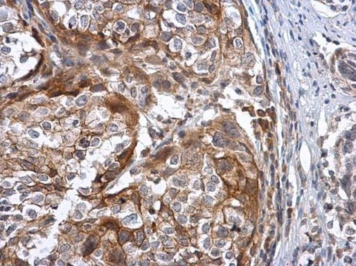 CD298 Antibody in Immunohistochemistry (Paraffin) (IHC (P))