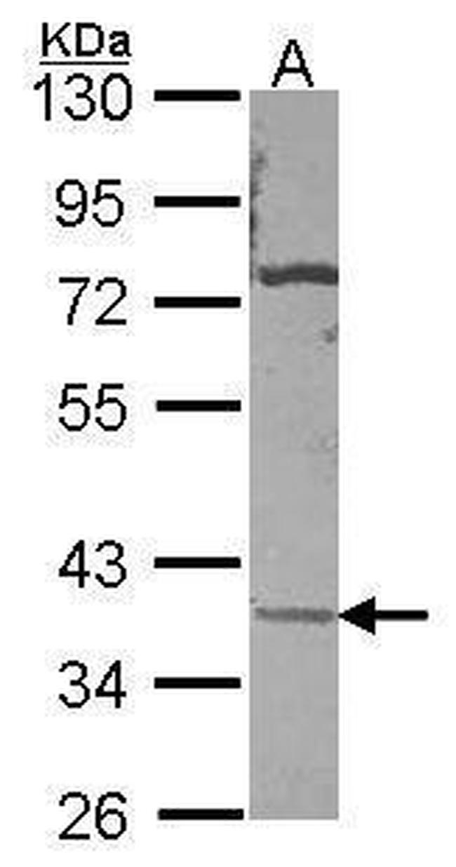 Carbonic Anhydrase XI Antibody in Western Blot (WB)