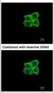 LAD1 Antibody in Immunocytochemistry (ICC/IF)