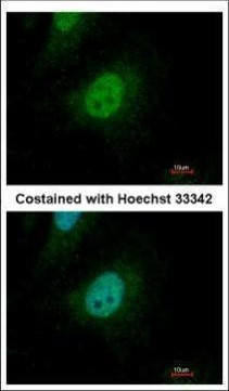 SMAD9 Antibody in Immunocytochemistry (ICC/IF)