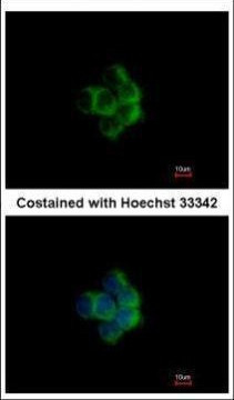 NDUFA10 Antibody in Immunocytochemistry (ICC/IF)