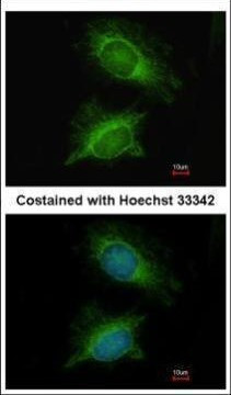PGM3 Antibody in Immunocytochemistry (ICC/IF)