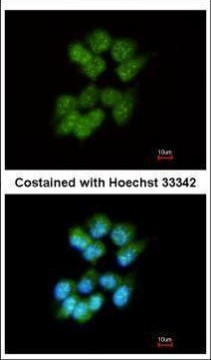 SLA Antibody in Immunocytochemistry (ICC/IF)
