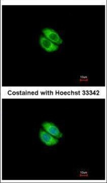 Syntrophin alpha-1 Antibody in Immunocytochemistry (ICC/IF)