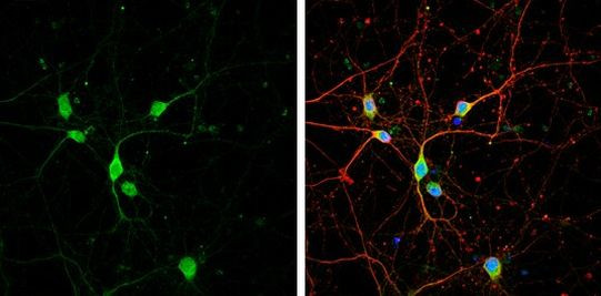 STX5 Antibody in Immunocytochemistry (ICC/IF)