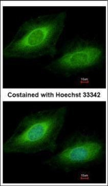 TSSC1 Antibody in Immunocytochemistry (ICC/IF)