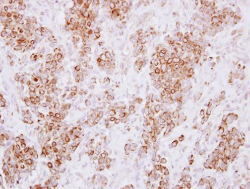 HLA-DMA Antibody in Immunohistochemistry (Paraffin) (IHC (P))