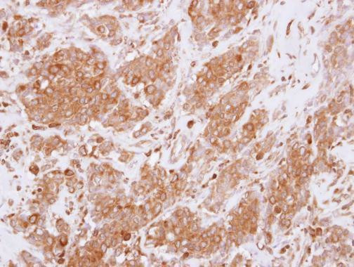 RGS10 Antibody in Immunohistochemistry (Paraffin) (IHC (P))