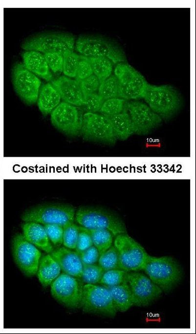 ARHGEF5 Antibody in Immunocytochemistry (ICC/IF)