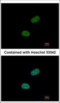 SRPX Antibody in Immunocytochemistry (ICC/IF)