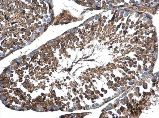 AP4M1 Antibody in Immunohistochemistry (Paraffin) (IHC (P))