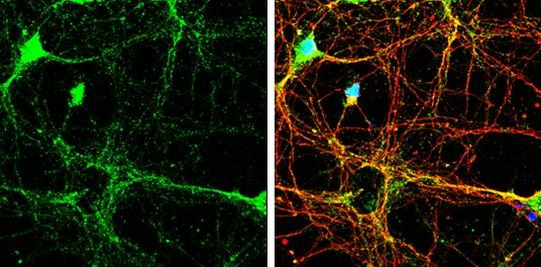 HOMER3 Antibody in Immunocytochemistry (ICC/IF)