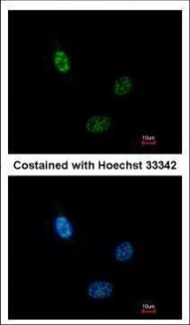 HEAB Antibody in Immunocytochemistry (ICC/IF)