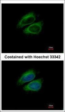 CSDE1 Antibody in Immunocytochemistry (ICC/IF)