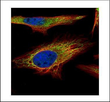 PNPase Antibody in Immunocytochemistry (ICC/IF)