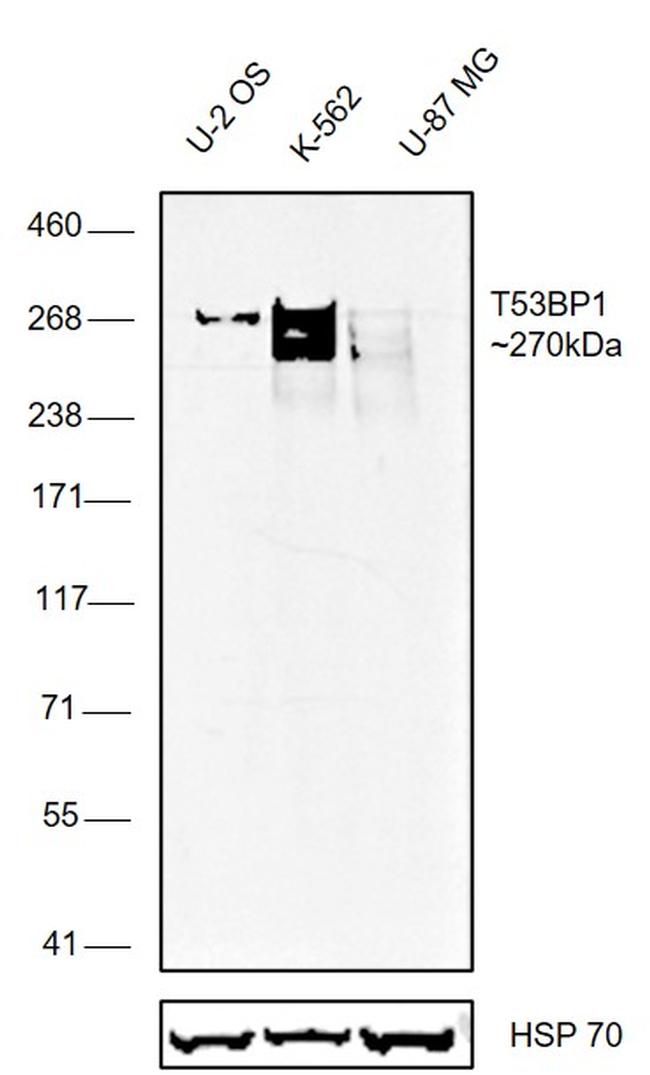 53BP1 Antibody in Western Blot (WB)