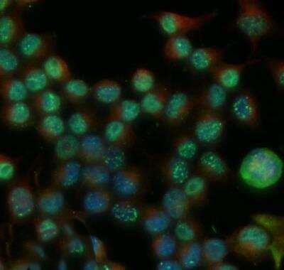 53BP1 Antibody in Immunocytochemistry (ICC/IF)