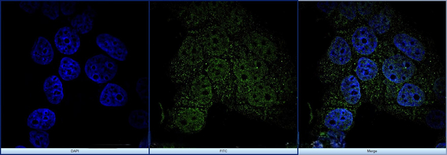 FOXP3 Antibody in Immunocytochemistry (ICC/IF)