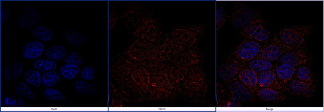 FOXP3 Antibody in Immunocytochemistry (ICC/IF)