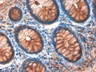 NOTCH4 Antibody in Immunohistochemistry (Paraffin) (IHC (P))