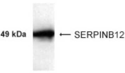 SERPINB12 Antibody in Western Blot (WB)
