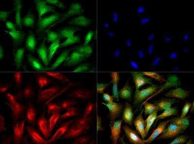 ACSL1 Antibody in Immunocytochemistry (ICC/IF)