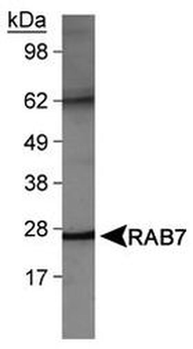RAB7 Antibody in Western Blot (WB)