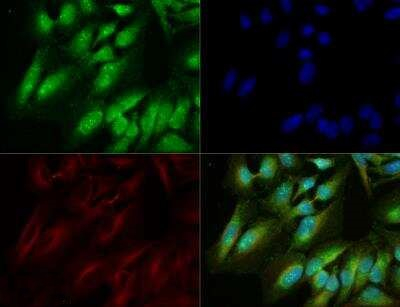 GLUT9 Antibody in Immunocytochemistry (ICC/IF)