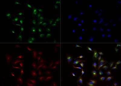 LCAT Antibody in Immunocytochemistry (ICC/IF)