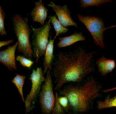 GRP78 Antibody in Immunocytochemistry (ICC/IF)