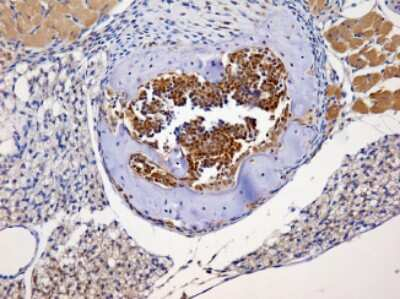 NBS1 Antibody in Immunohistochemistry (Paraffin) (IHC (P))